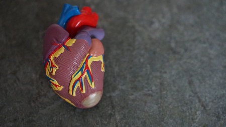 بیماری قلبی, علت ایجاد پی وی سی قلب, pvc قلب