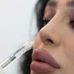 تزریق ژل به بینی روشی بی خطر و کم هزینه برای اصلاح فرم بینی