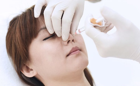 کاربردهای تزریق ژل به بینی, کاندیدای مناسب تزریق ژل به بینی, مزیت های تزریق ژل به بینی