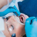 جراحی دندان شامل چه مواردی است؟ مراقبت بعد از جراحی