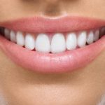 روش های شگفت انگیز برای مرتب کردن دندان ها بدون ارتودنسی