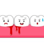 علت خونریزی لثه های شما + قطع فوری خونریزی دندان