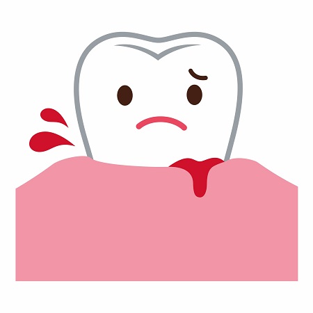 درمان خونریزی دندان, قطع فوری خونریزی دندان, خونریزی دندان