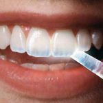 میناکاری دندان چیست و چگونه انجام می شود؟